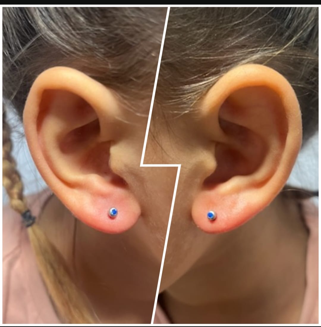 Piercing Progress 4